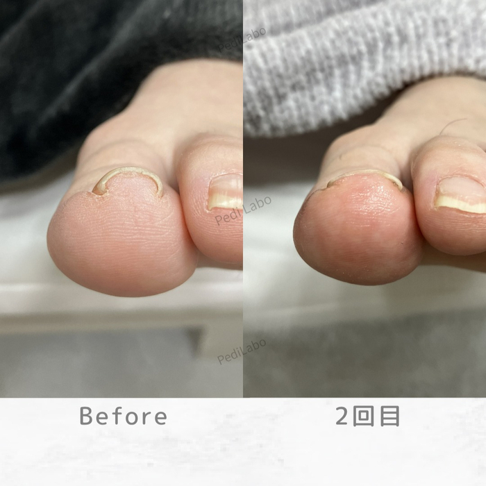 画像315