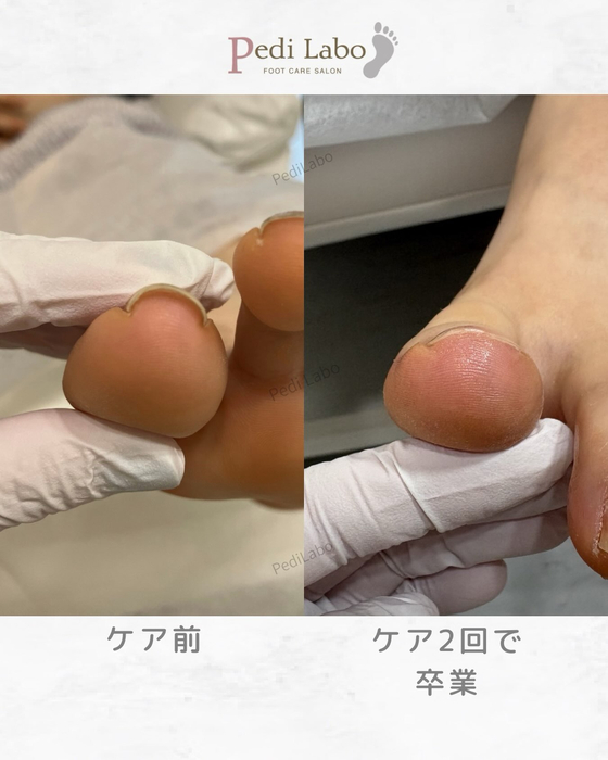 画像324