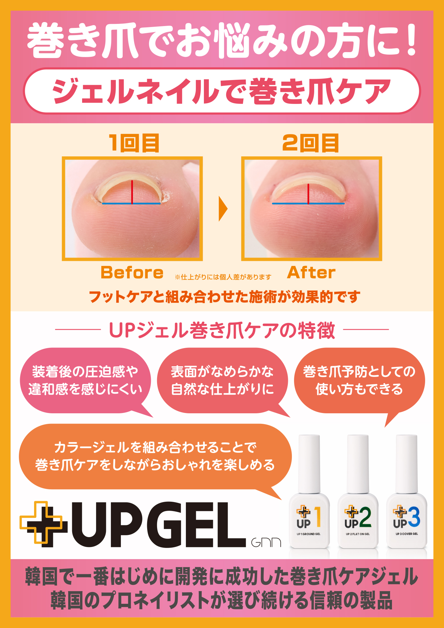 UPジェルの効果とは？